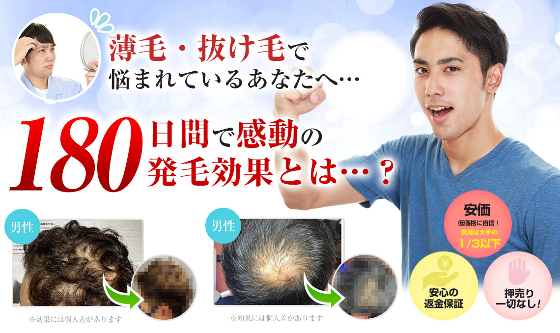薄毛・抜け毛で悩まれているあなたへ…90日間で感動の発毛効果とは…？
